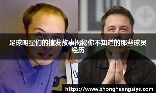 足球明星们的植发故事揭秘你不知道的那些球员经历
